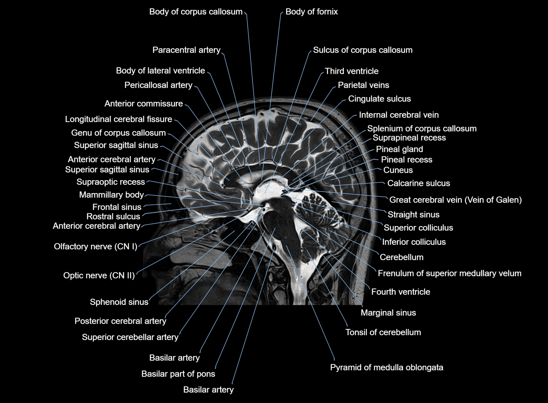 brain sagittal anatomy 3T MRI images -img-00001-00033.webp